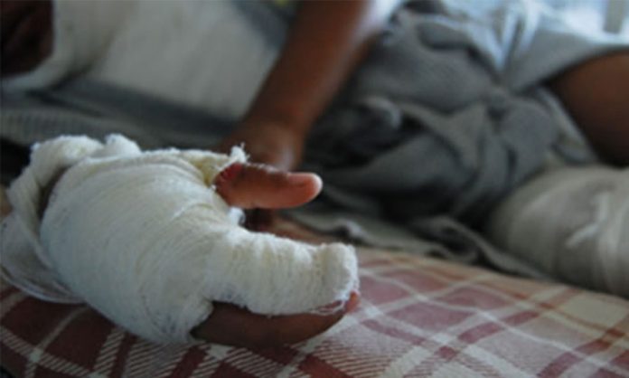 Lesionados por pólvora en Marinilla.