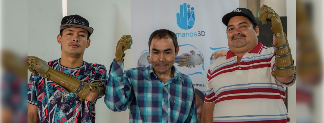 web-ceja-protesis-miembro-superior