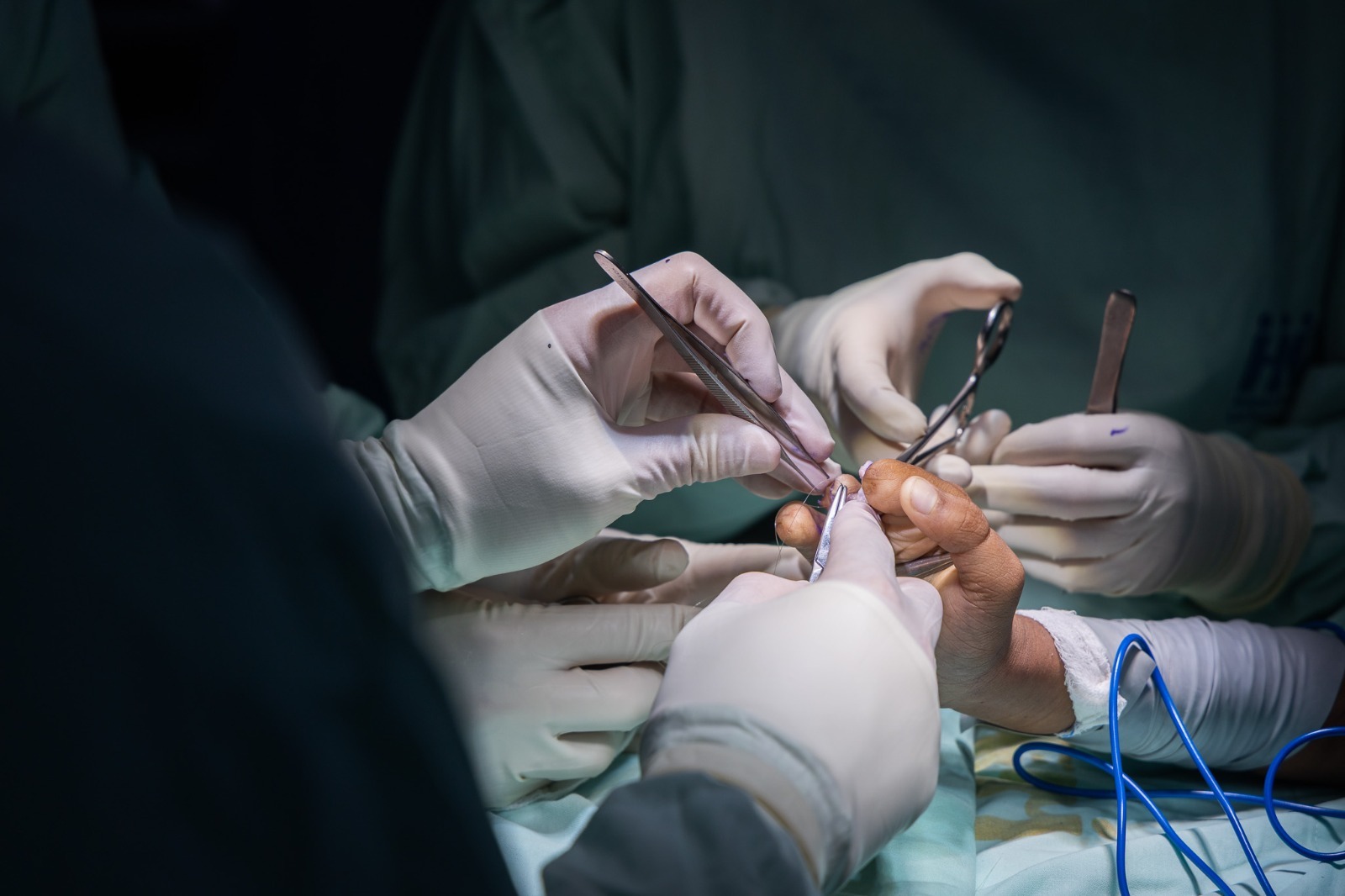 Más de 110 menores con traumas o deformidades en sus manos recibieron cirugías gratuitas para corregirlas en Medellín