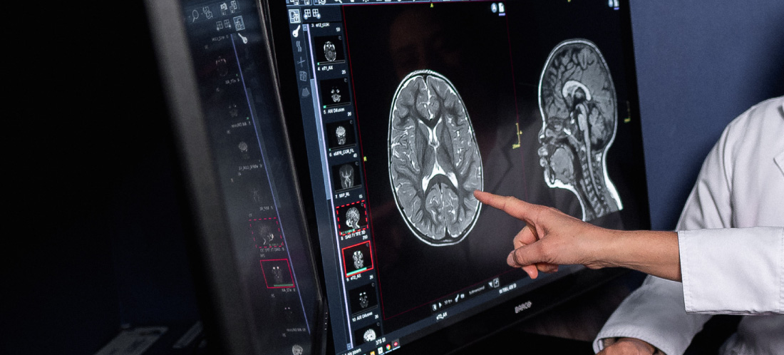 Hospital Infantil San Vicente Fundación, referente nacional en neurocirugía pediátrica avanzada
