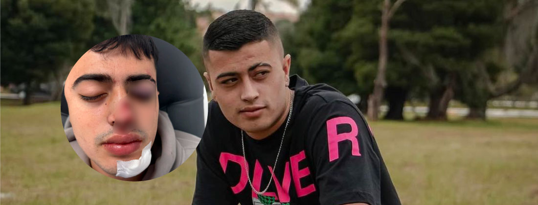 Nuevos detalles del robo y golpiza a un joven tras salir de Provenza: lo llevaron hasta Itagüí y lo abandonaron en La Candelaria
