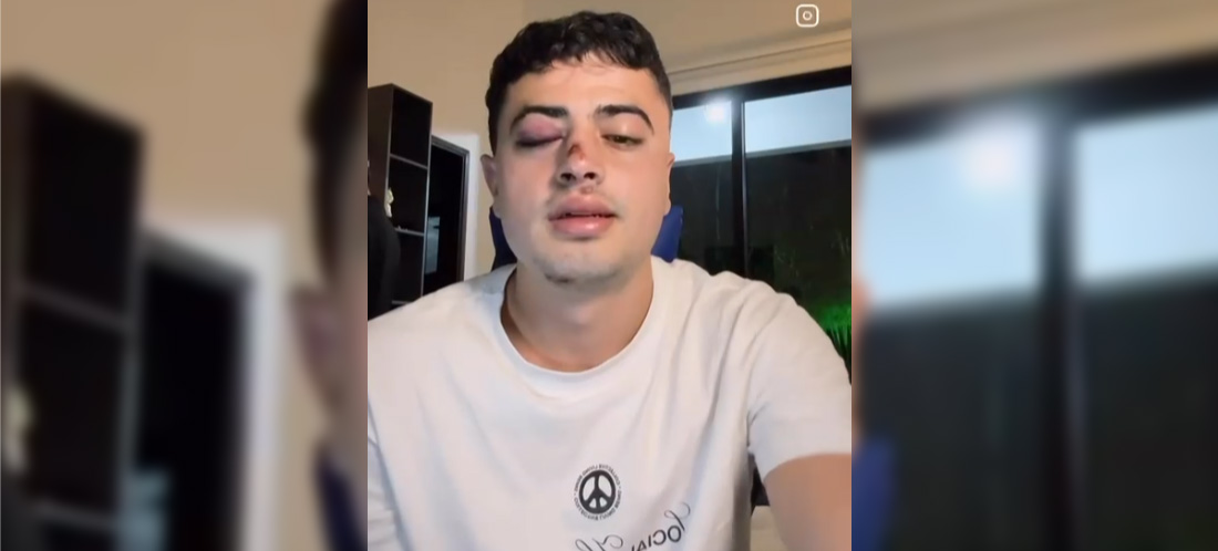 Joven denuncia robo con escopolamina y golpiza, al parecer, por un conductor de taxi, cuando salió de Provenza