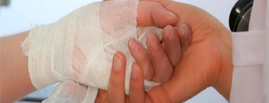 Aumento del 29,5 % de lesionados por pólvora en Antioquia: van 136 casos, 17 en el Oriente