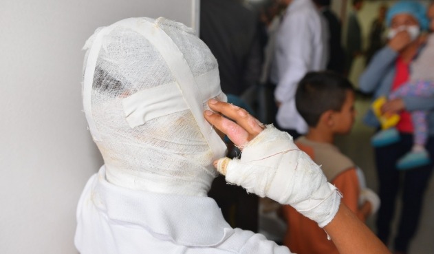 ¡Que pena! Oriente es la segunda subregión con más quemados por pólvora esta temporada con 33. Antioquia llegó a 189