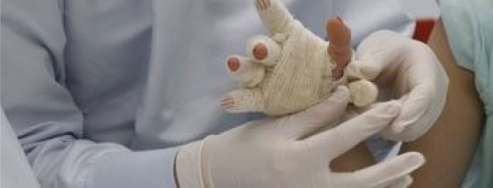 web-Muy-mal,-Antioquia-173-quemados-por-pólvora-en-la-temporada-decembrina,-26-casos-solo-en-la-celebración-del-año-nuevo